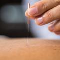 Experience the Power of Balance Method Acupuncture